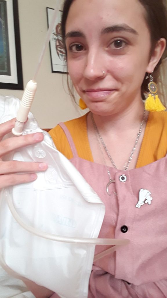 Catheters And Me A True Story From Year Old Gemma Bladder Bowel Community