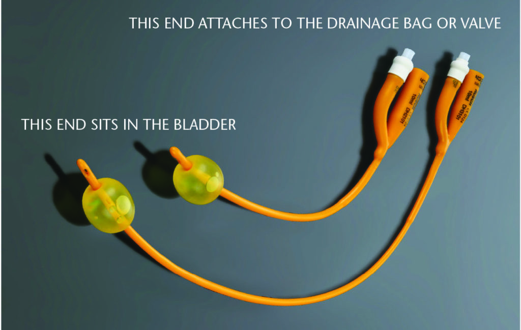 How Does A Catheter Work?  Bladder & Bowel Community